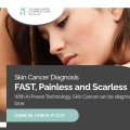 Painless, Scarless and Minimally Invasive Mole Removal Laser Procedure