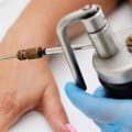 Types of Freezing Mole Removal
