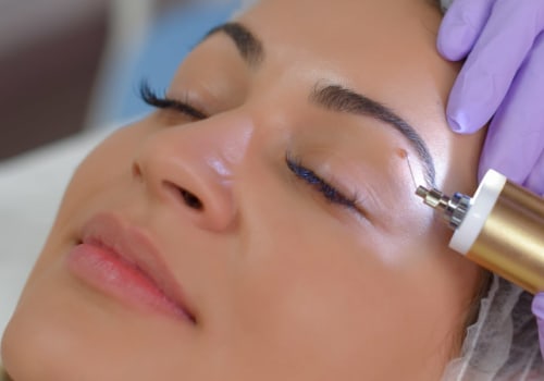 Chemical treatments for Mole Removal Procedures